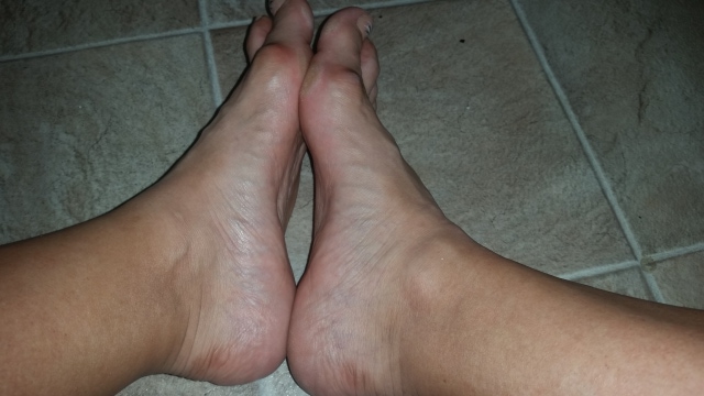 Left foot - slight welling